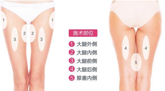 哪些明星腿部抽脂,腿部抽脂术后的华丽蜕变